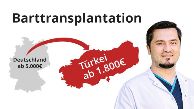 Barthaartransplantation Türkei Kosten