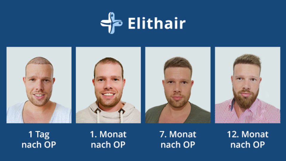 Bild zum Artikel Top-Ergebnisse in Spezialklinik