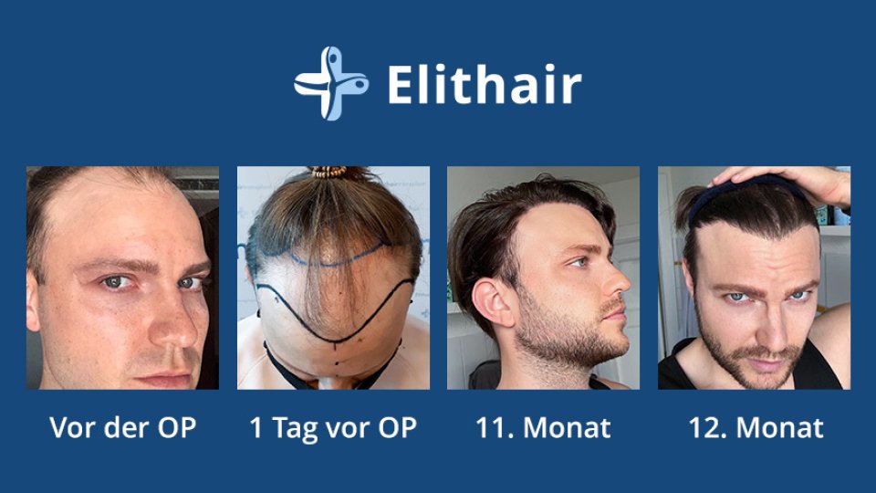 Bild zum Artikel Top-Ergebnisse in Spezialklinik