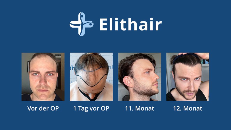 Bild zum Artikel Top-Ergebnisse in Spezialklinik