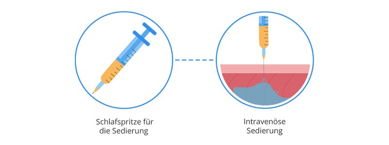 Haartransplantation - Betäubung unter Sedierung